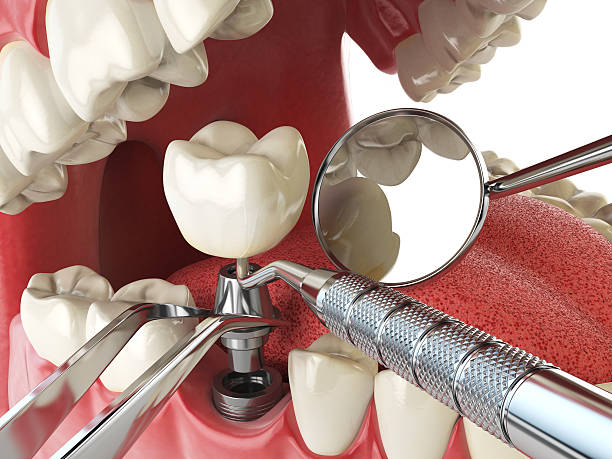 Best Emergency Dentist for Knocked-Out Tooth in Wagner, SD